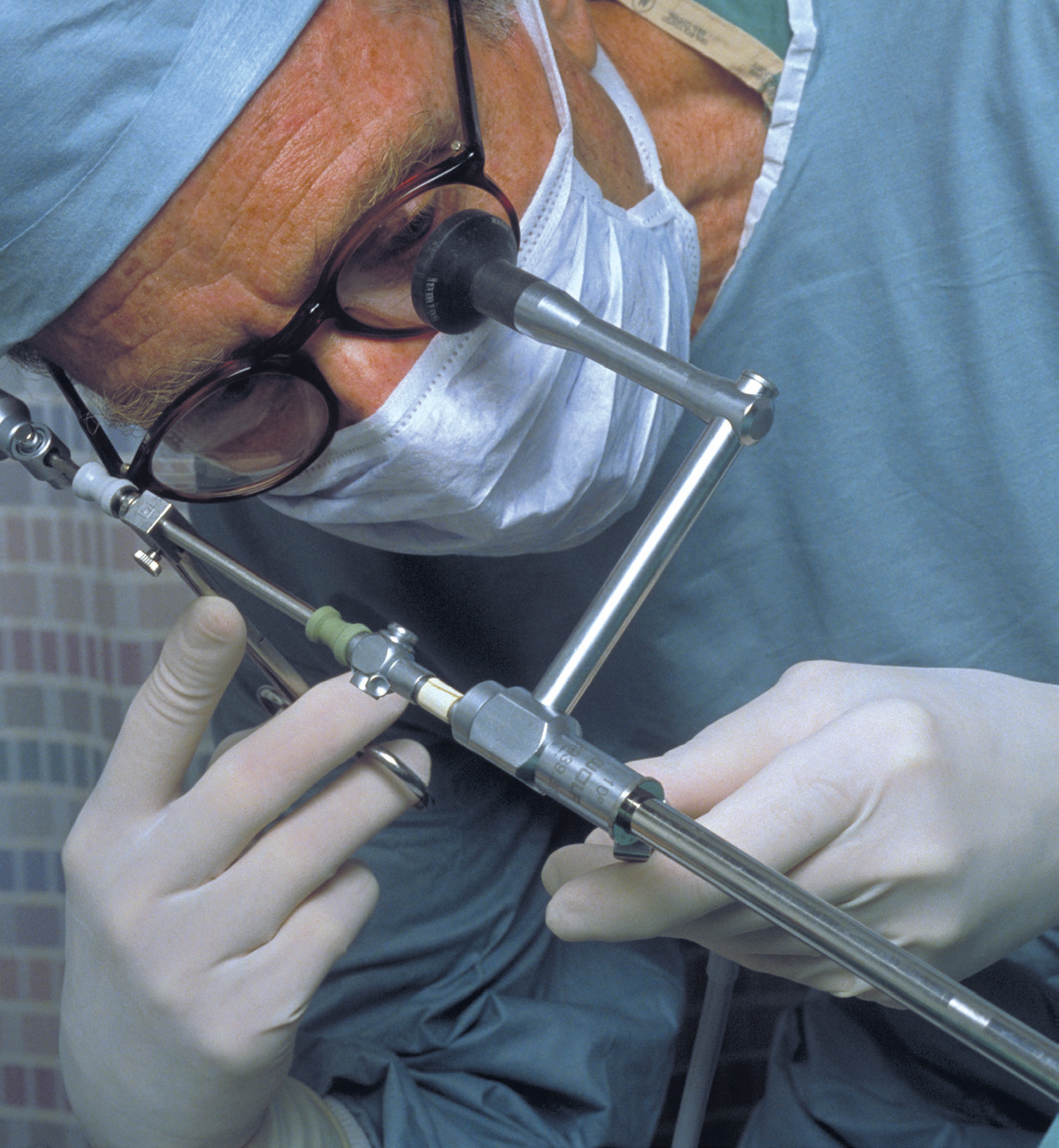 Hysteroscopy Doctor Hysteroscopy