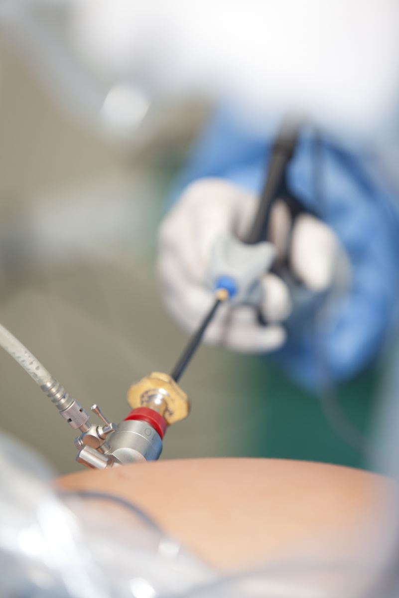 Laparoscope Laparoscope